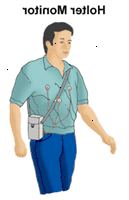 Illustration av en man som bär en Holter bildskärm