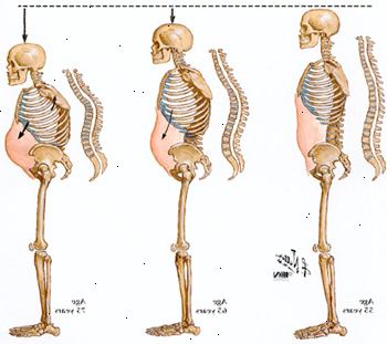 Hur ryggraden komprimerar med åldern