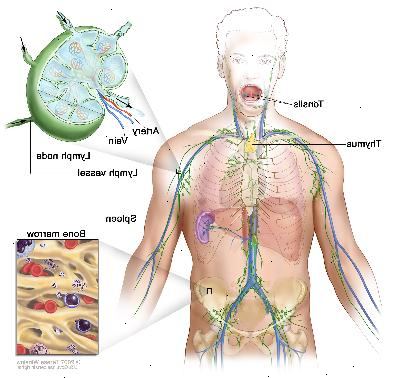 Lymfsystemet, ritning visar lymfkärl och lymfkörtlar organ, inklusive lymfkörtlar, tonsiller, bräss, mjälte och benmärg. En infälld visar insidan strukturen av en lymfkörtel och de bifogade lymfkärlen med pilar som visar hur lymfan (klar vätska) rör sig in i och ut från lymfkörtel. En annan infällda bilden visar en närbild av benmärg med blodkroppar.