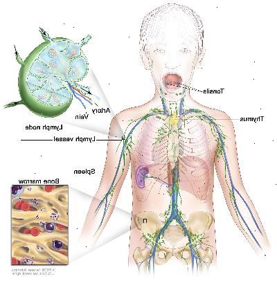 Lymfsystemet, ritning visar lymfkärl och lymfkörtlar organ, inklusive lymfkörtlar, tonsiller, bräss, mjälte och benmärg. En infälld visar insidan strukturen av en lymfkörtel och de bifogade lymfkärlen med pilar som visar hur lymfan (klar vätska) rör sig in i och ut från lymfkörtel. En annan infällda bilden visar en närbild av benmärg med blodkroppar.