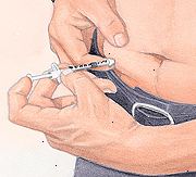 Patient injicera insulin i buken