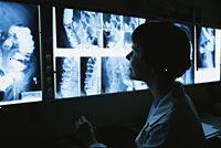 Bild på en läkare tittar barium lavemang x-ray-filmer