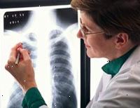 Bild av en kvinnlig röntgenläkare läser en röntgenbild