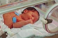 Bild av en baby i neonatal intensivvårdsavdelning