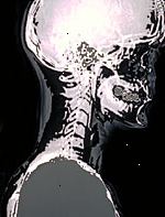 En bild av en röntgenbild av huvudet