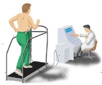 Illustration som visar ett arbets-EKG