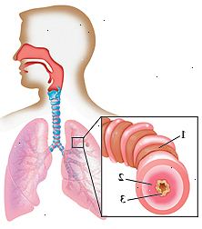 Disposition av människans huvud och bröst med huvudet vänt till sida som visar insidan av näsan, halsen och luftstrupen som leder till lungorna i bröstkorgen. Närbild av luftvägs visar åt muskler, svullna foder, och ökad slem.